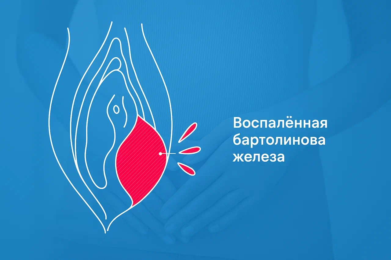 Бартолинит Бартолинит