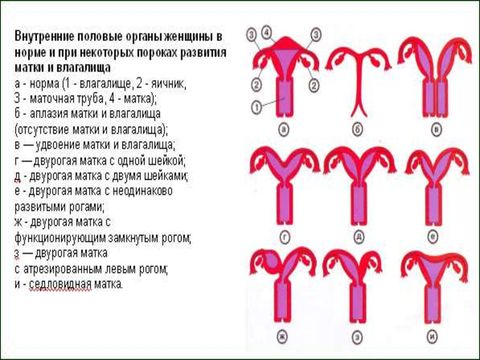 Анатомия строения двурогой матки. Что такое двурогая матка и как она выглядит?