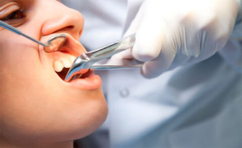 Удаление зуба, заболевания
