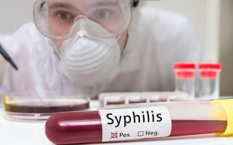 Как правильно сдать анализы на сифилис