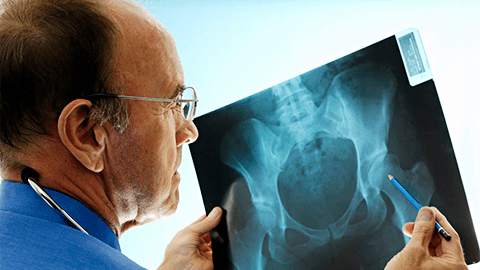 Какие болезни диагностирует рентгенография
