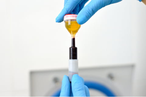 аутоплазмотерапия