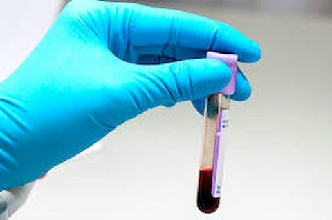 Анализ крови на паразитов 