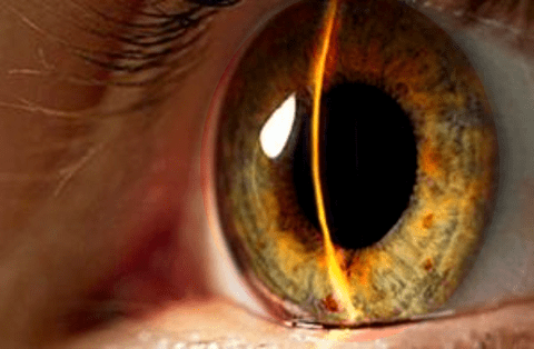 Биомикроскопическое исследование глаза