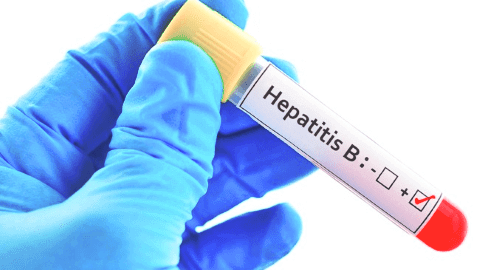 Анализ крови на гепатит В