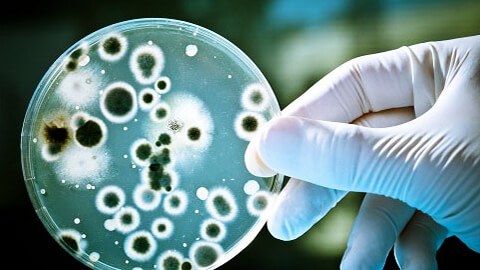 Бактериологическое исследование