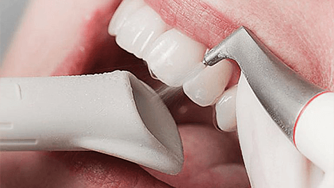 Чистка зубов Air-flow