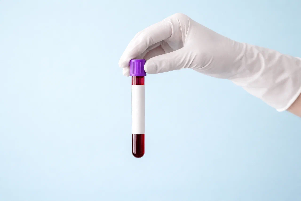 diagnostika dislipidemii