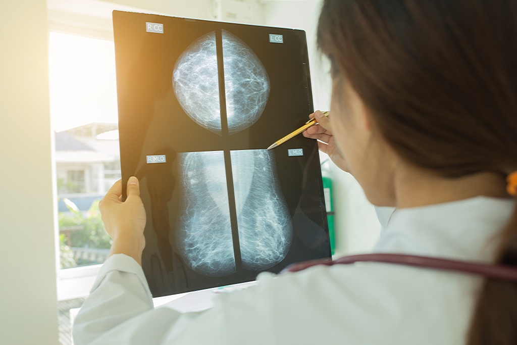 Маммография статья рентген