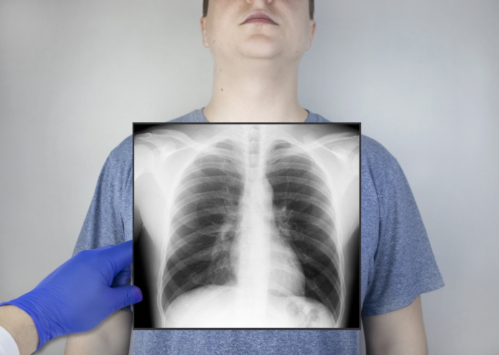 Как сделать эффект рентгена на фото