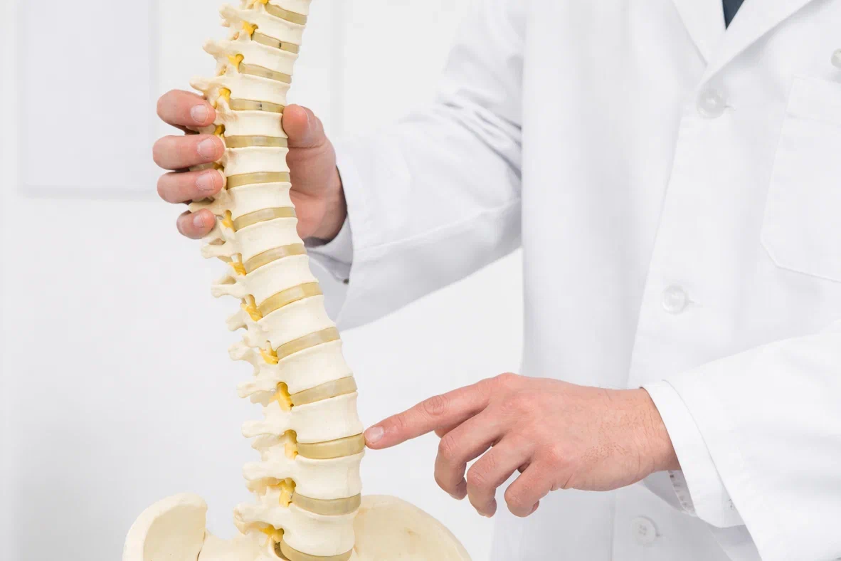 vidy spondiloartroza