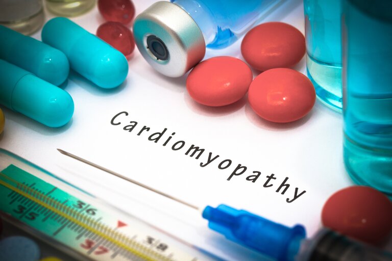 Виды кардиомиопатии