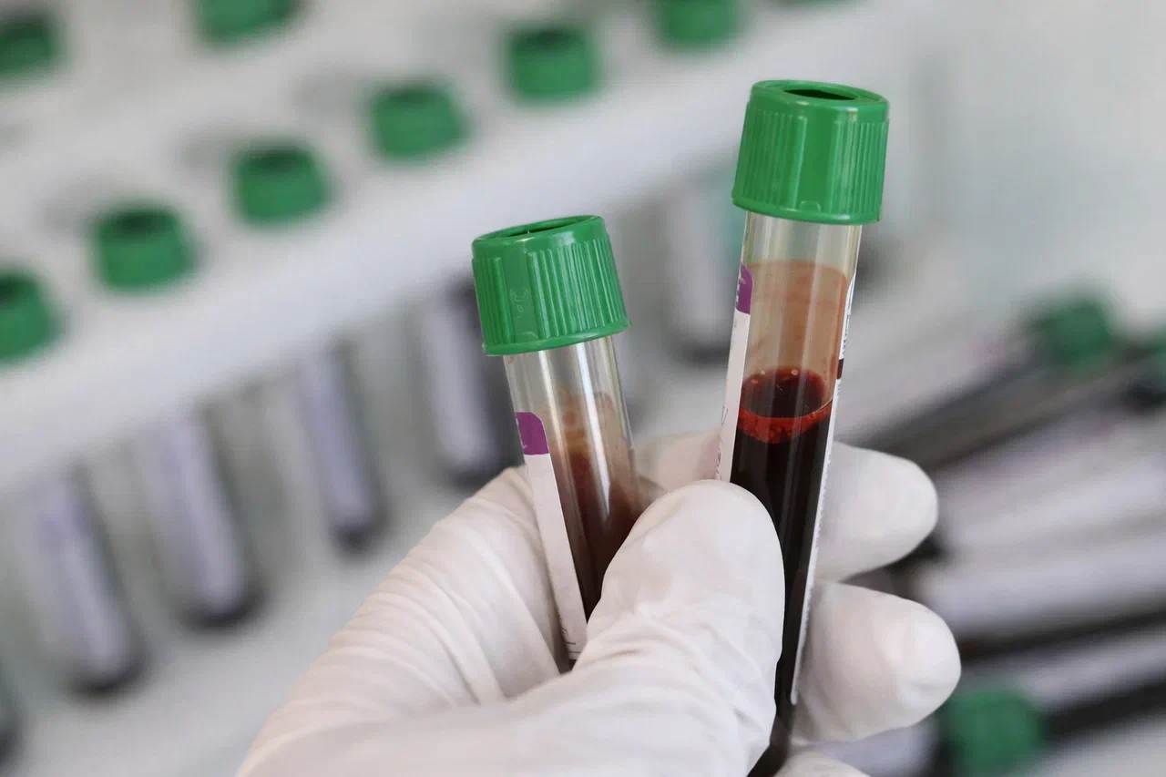 Provedenie analiza na fermenty