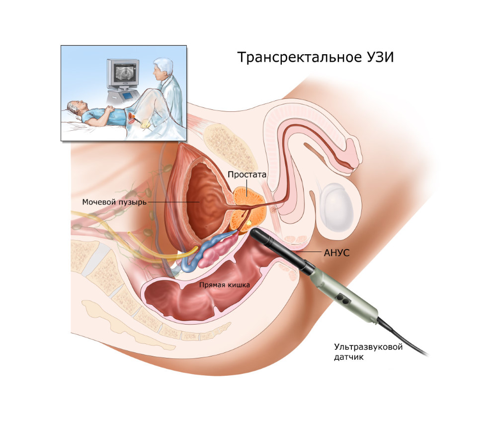 УЗИ предстательной железы трансабдоминально в Москве (Отрадное и Митино) по  выгодной цене 1960 руб. Записаться онлайн!