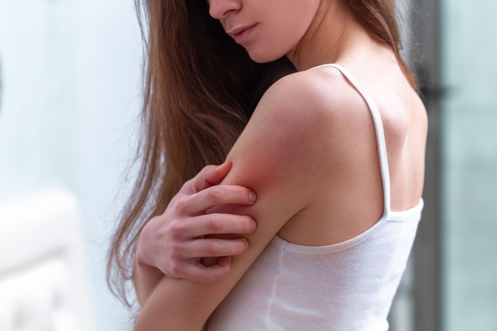 Аллергические поражения кожи