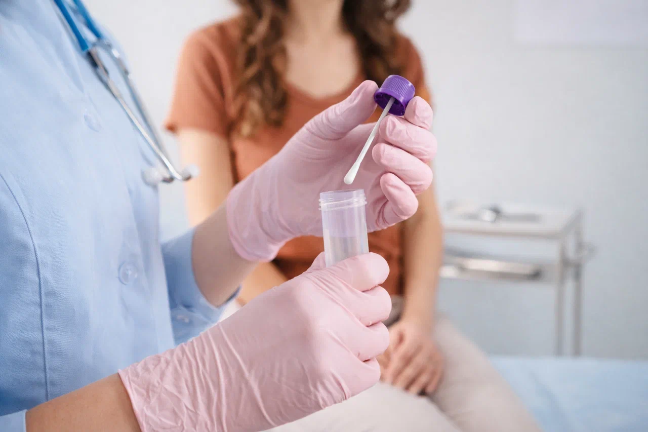 diagnostika kandidoza