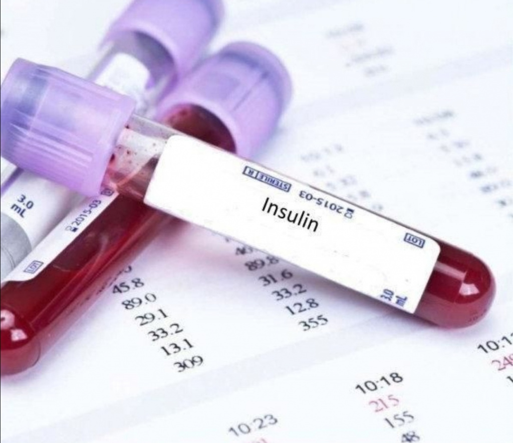 analiz-na-insulin analiz-na-insulin