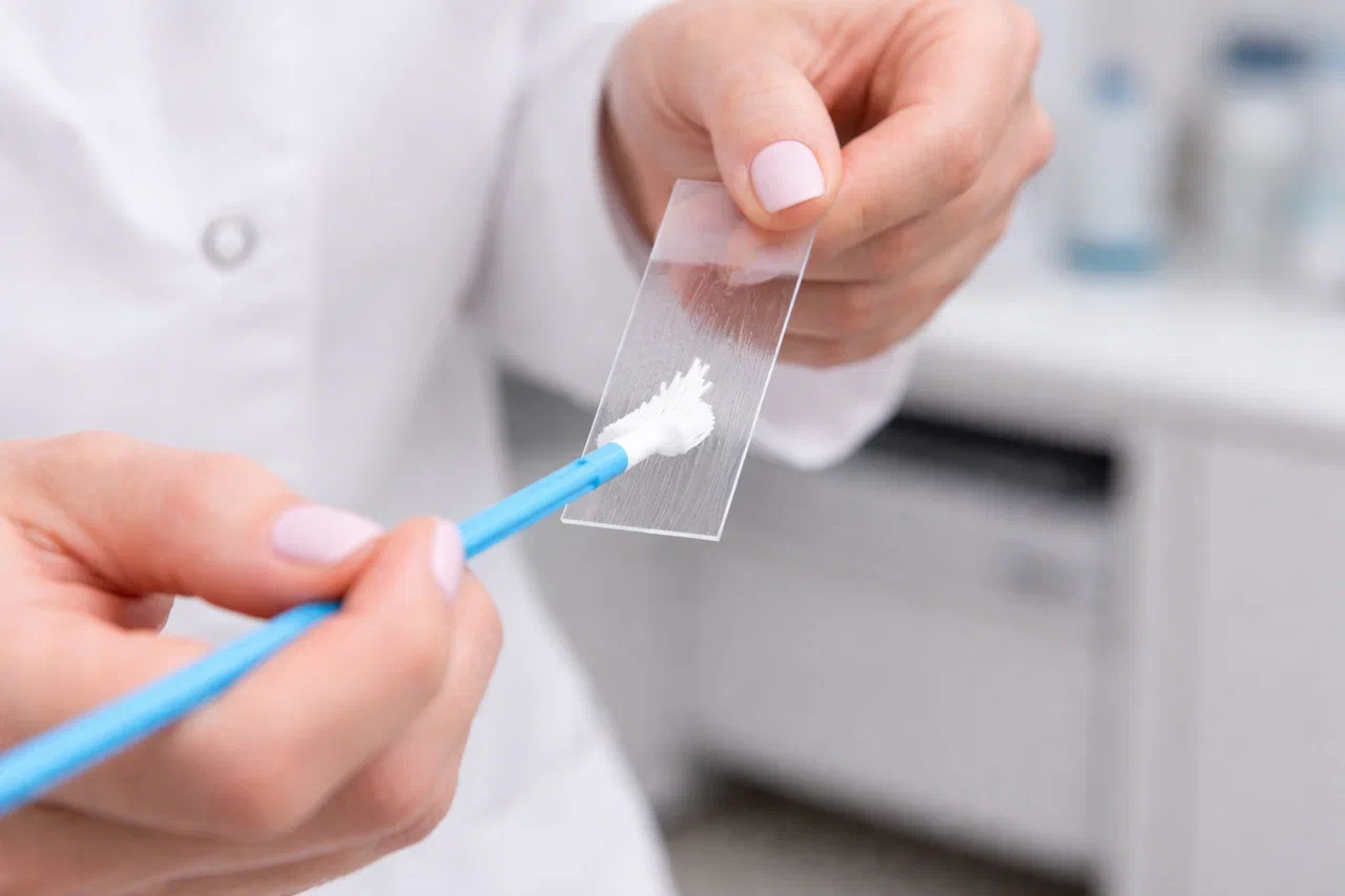 provedenie zhidkostnoj citologii