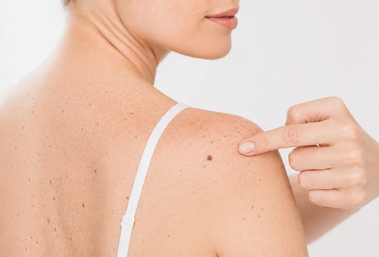 simptomy-dermatolog