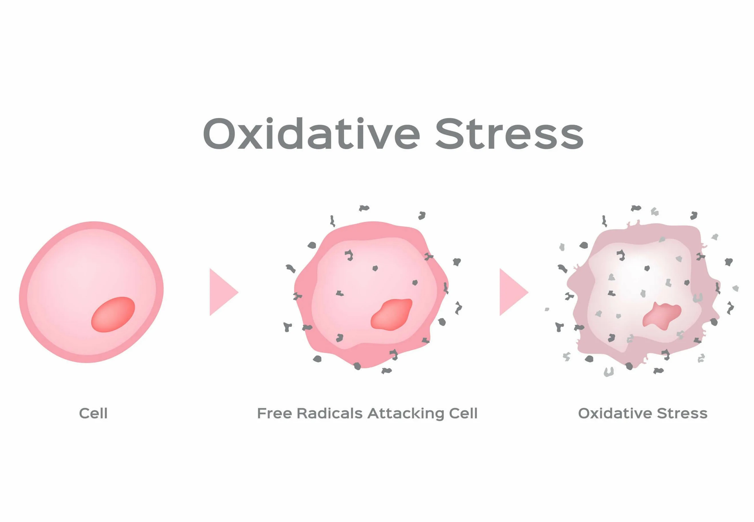 oksidativniy-stress.jpeg